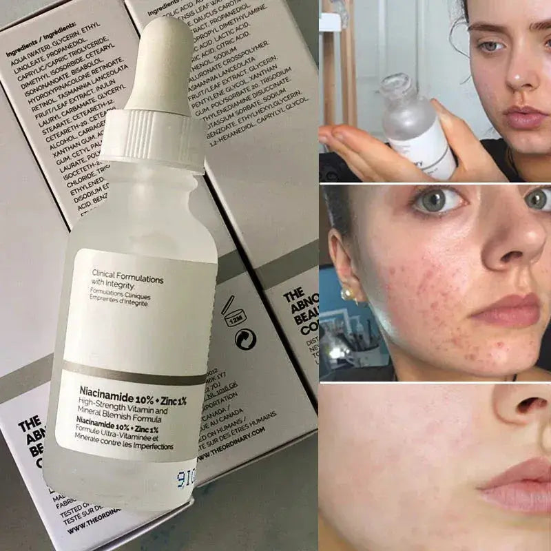 The Ordinary Niacinamide 7% Mejora la textura y unifica el tono de la piel